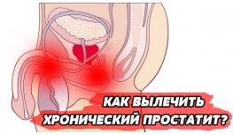 Остеохондроз шейного отдела, шум в ушах, тянет горло и шею Лучшие препараты для лечения простатита